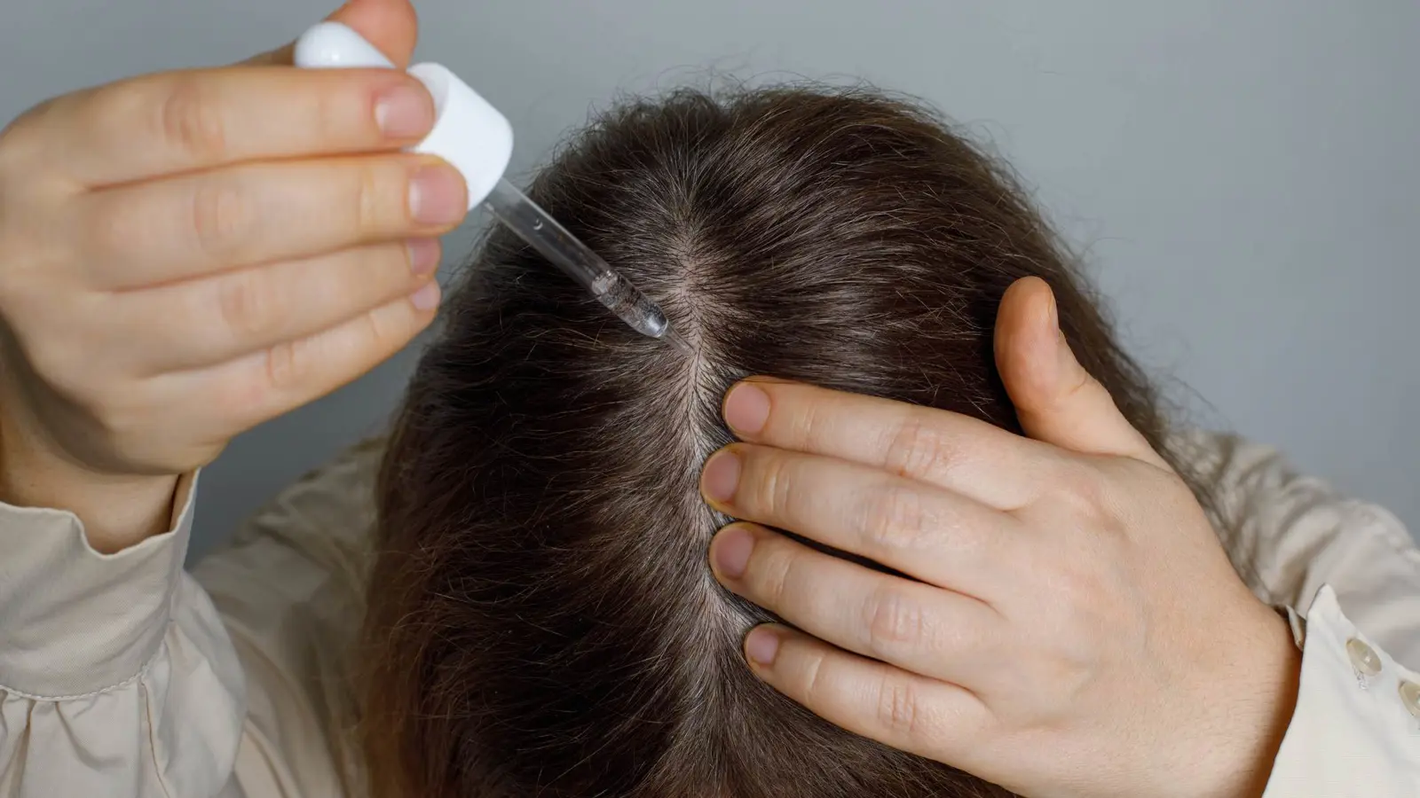 "المينوكسيديل" لتساقط الشعر.. متى يصبح خطرا على صحتك؟