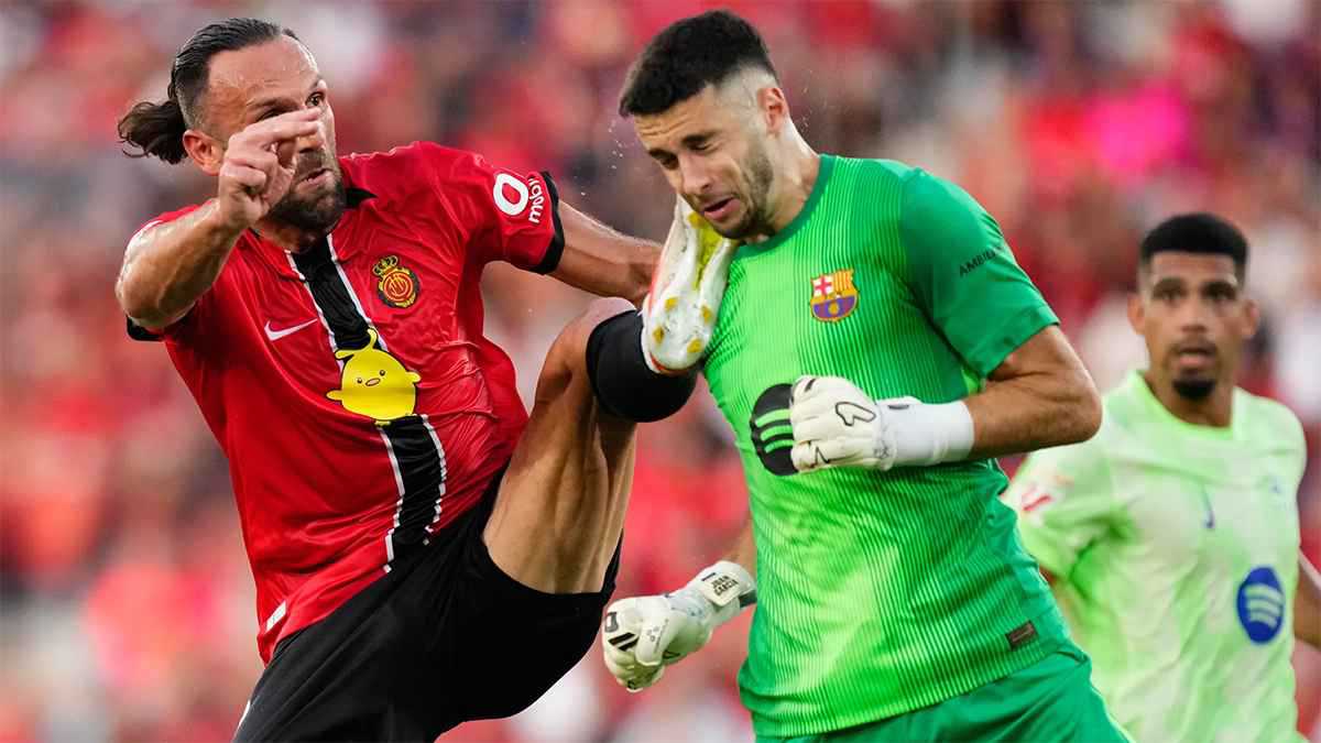 وجه متورم.. آثار التدخل العنيف تظهر على حارس برشلونة (صور)