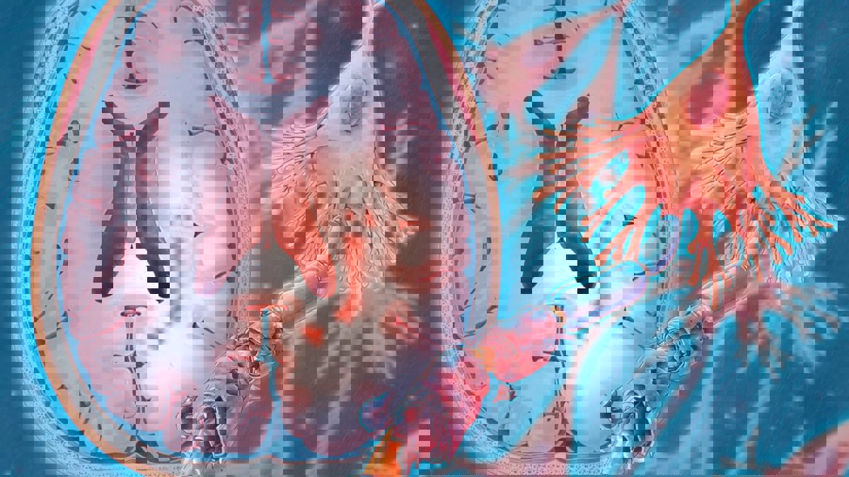 ثورة طبية قد توقف التصلب اللويحي في مراحله المتقدمة 