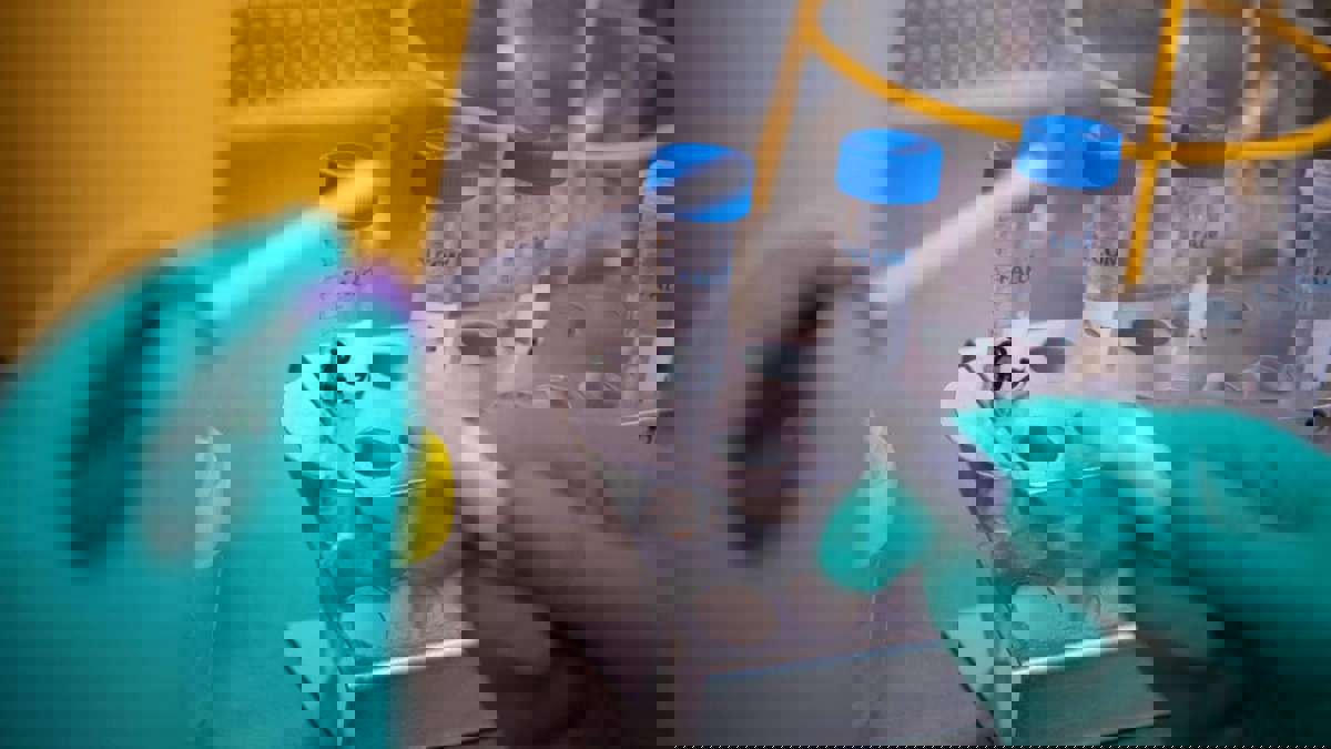 من الأعراض إلى إمكانية العلاج .. ما تحتاج معرفته عن فيروس هانتا