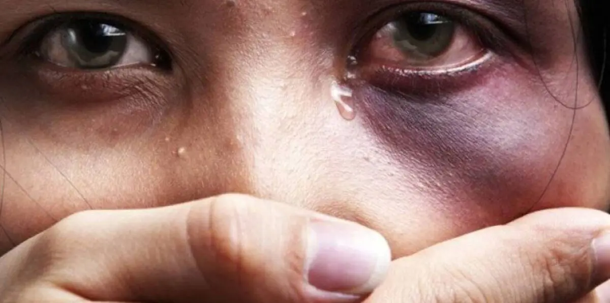 السعودية.. صدمة في قضية "معنفة أبها" باتهام مسؤول بـ"التستر"