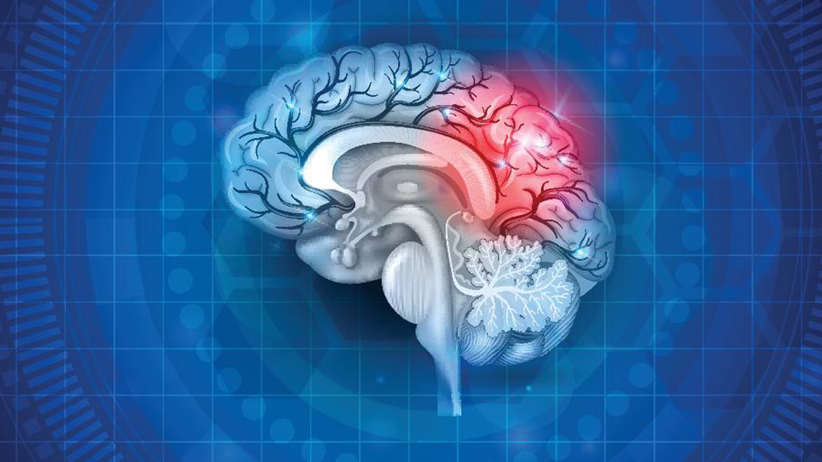 ابتكار مستشعر صغير يكشف عن إصابات الدماغ والفصام والخرف