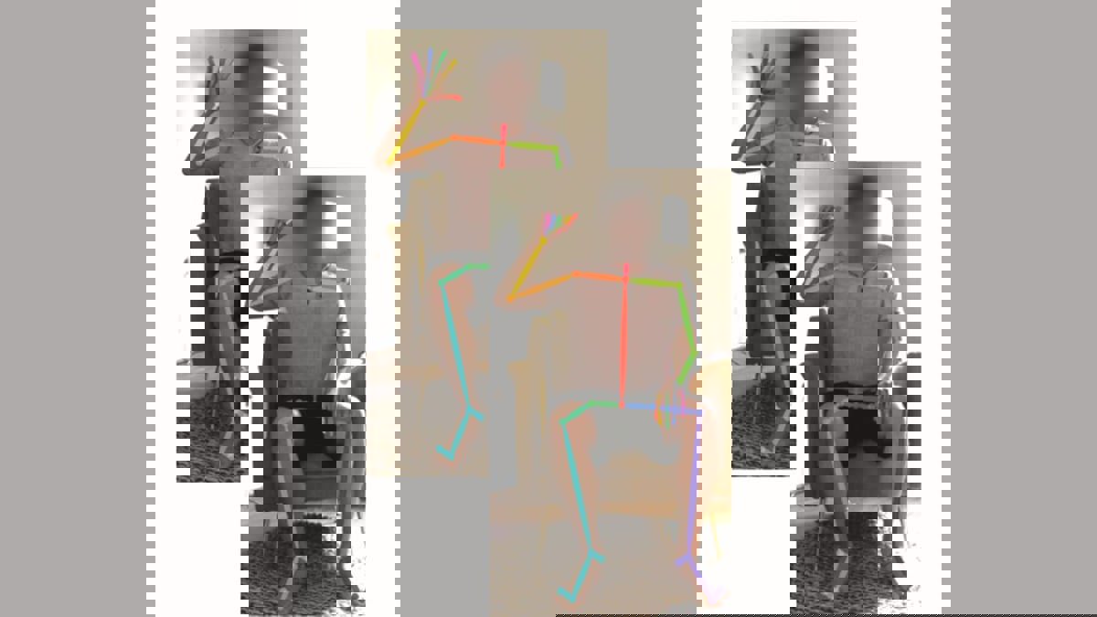 تقنية جديدة لفحص مرضى الأعصاب سريريا عبر هواتفهم الذكية