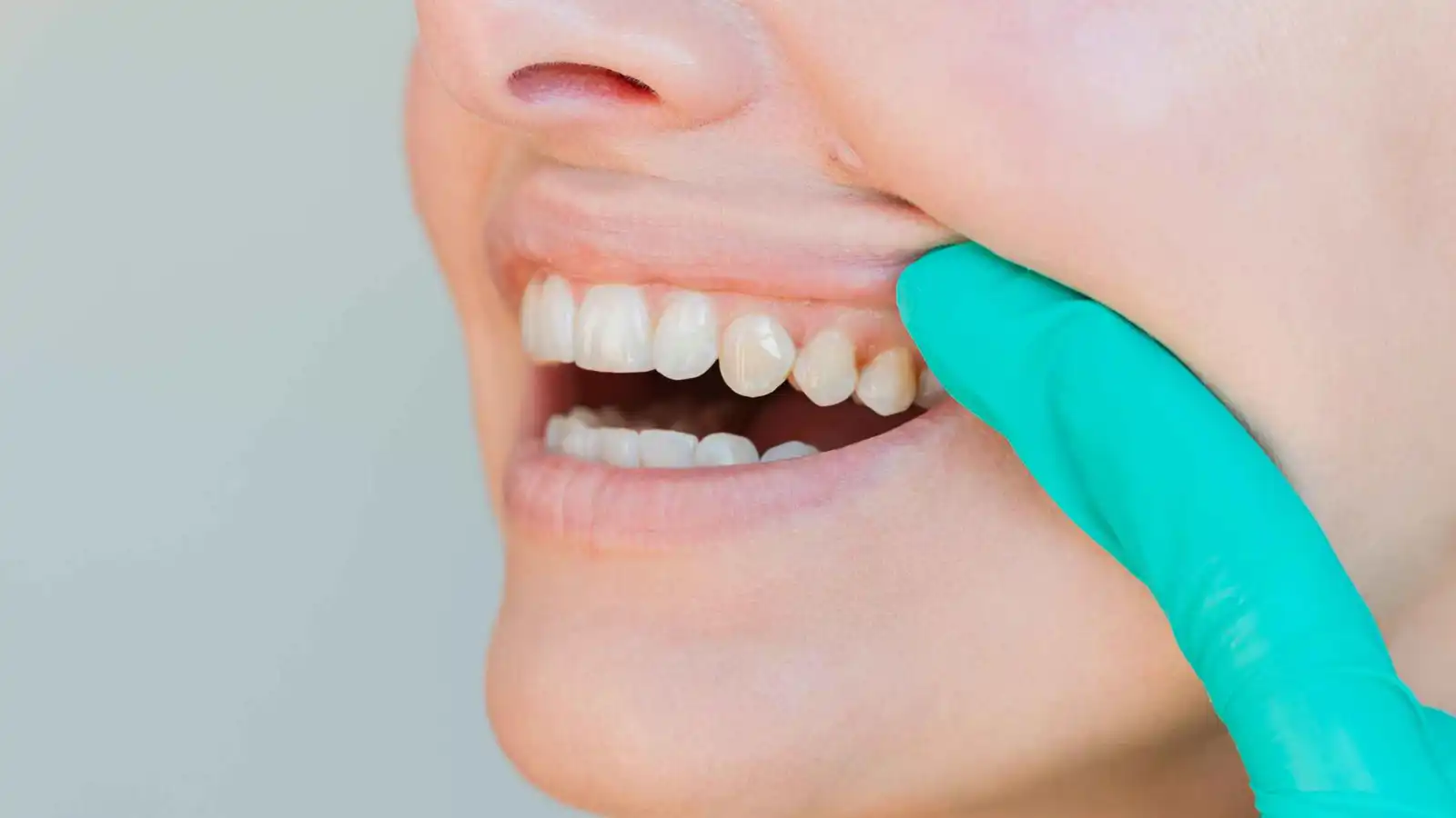 ابتكار علمي ثوري يساهم في إصلاح وتجديد مينا الأسنان