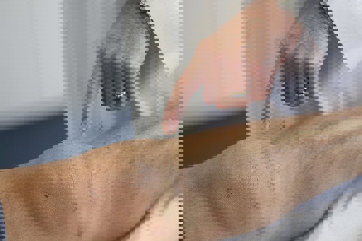 3 علامات على الساقين تشير إلى "القاتل الصامت"