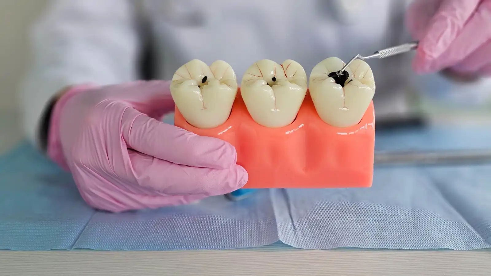 معجون أسنان بـ"بروتين الشعر" لعلاج التسوس