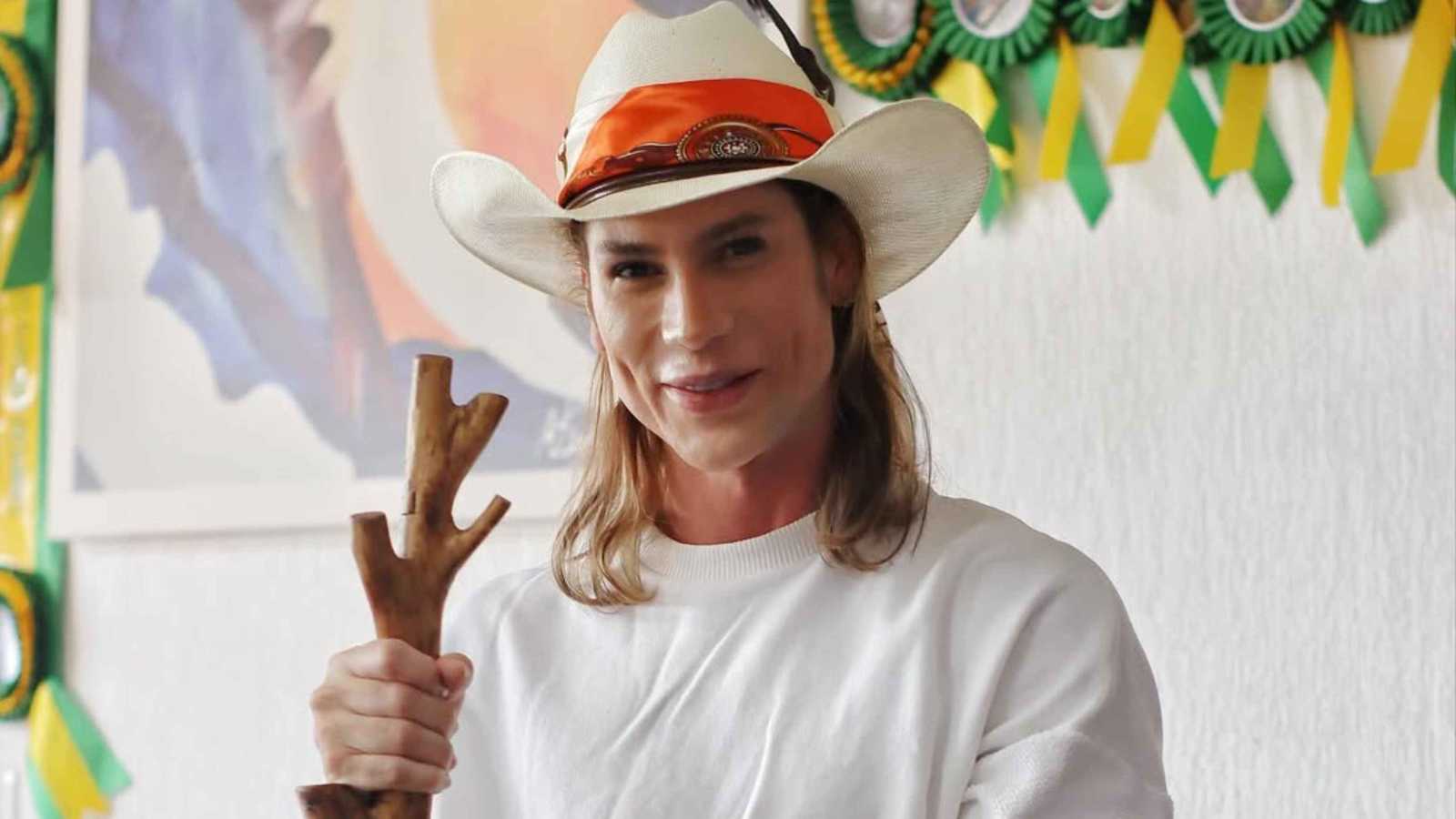 وفاة مؤثر برازيلي بعد مضاعفات جراحة "عيون الثعلب" (صور)