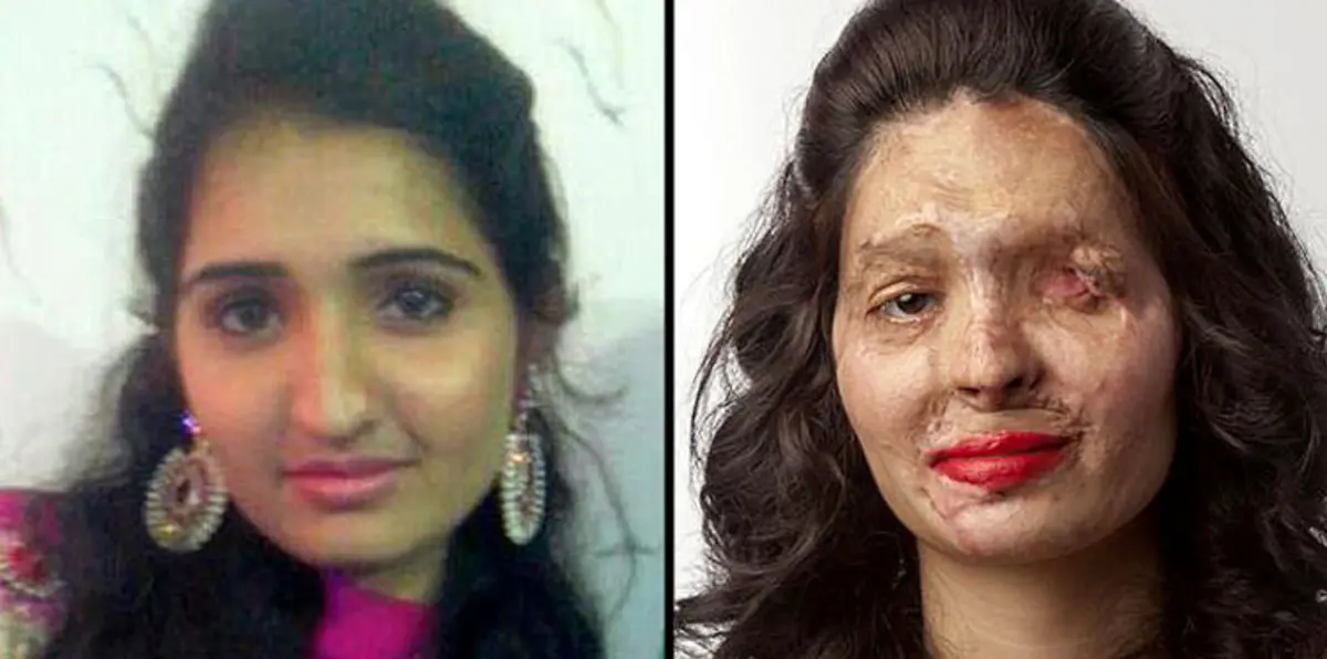 هندية مشوّهة الوجه من بين عارضات أسبوع الموضة بنيويورك