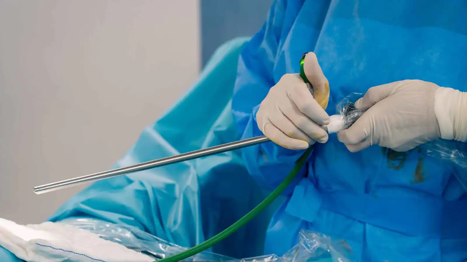 هل أصبح "تكميم المعدة" الحل الأقوى للسمنة؟