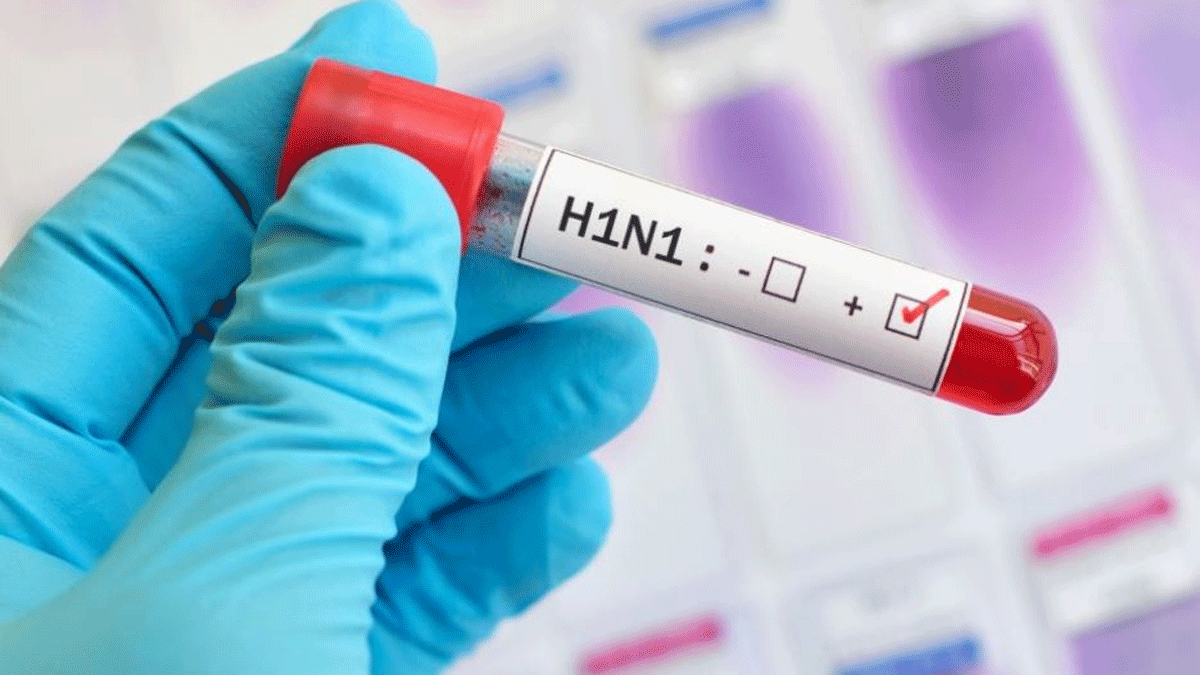 ارتفاع وفيات إنفلونزا الخنازير في المغرب إلى 16 شخصًا