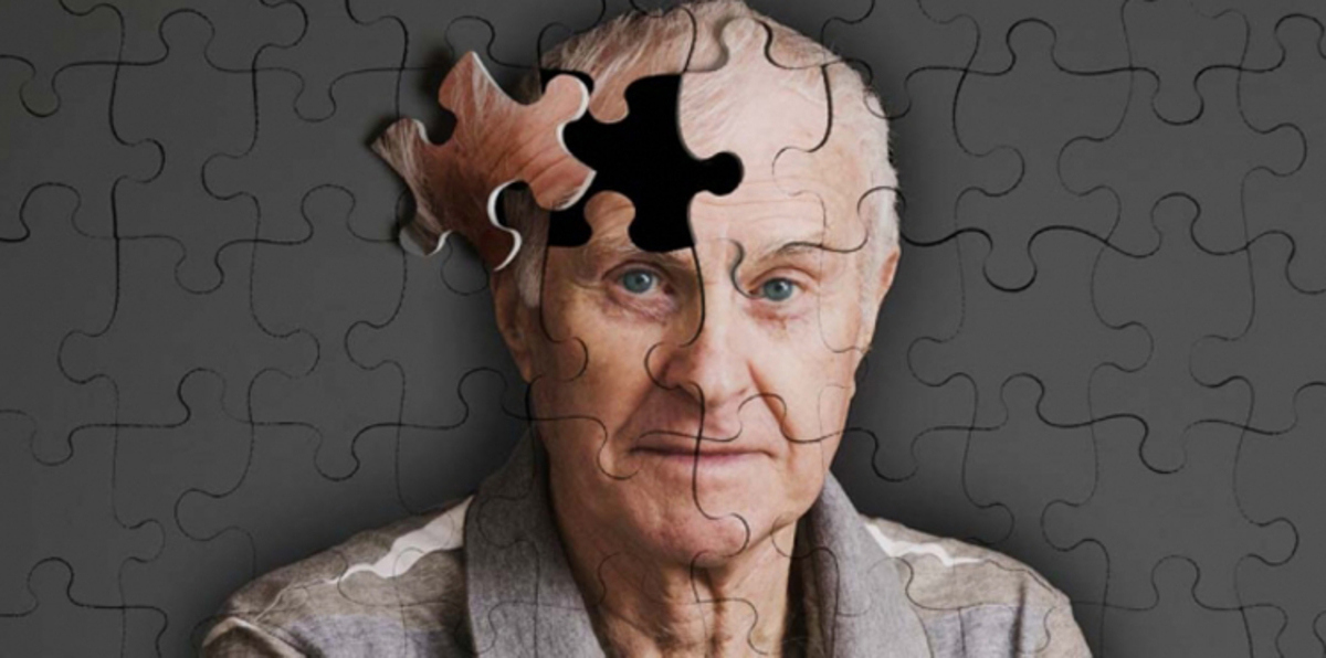 ما العلاقة بين مستويات الجلوكوز في الدماغ والزهايمر؟