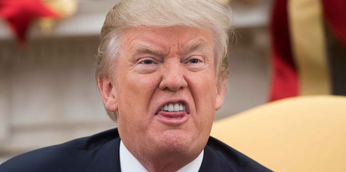 هل أجرى ترامب عملية زراعة شعر أم جراحة في فروة الرأس؟