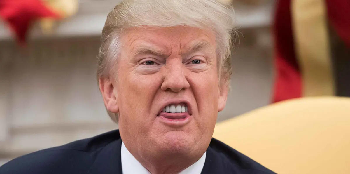 هل أجرى ترامب عملية زراعة شعر أم جراحة في فروة الرأس؟