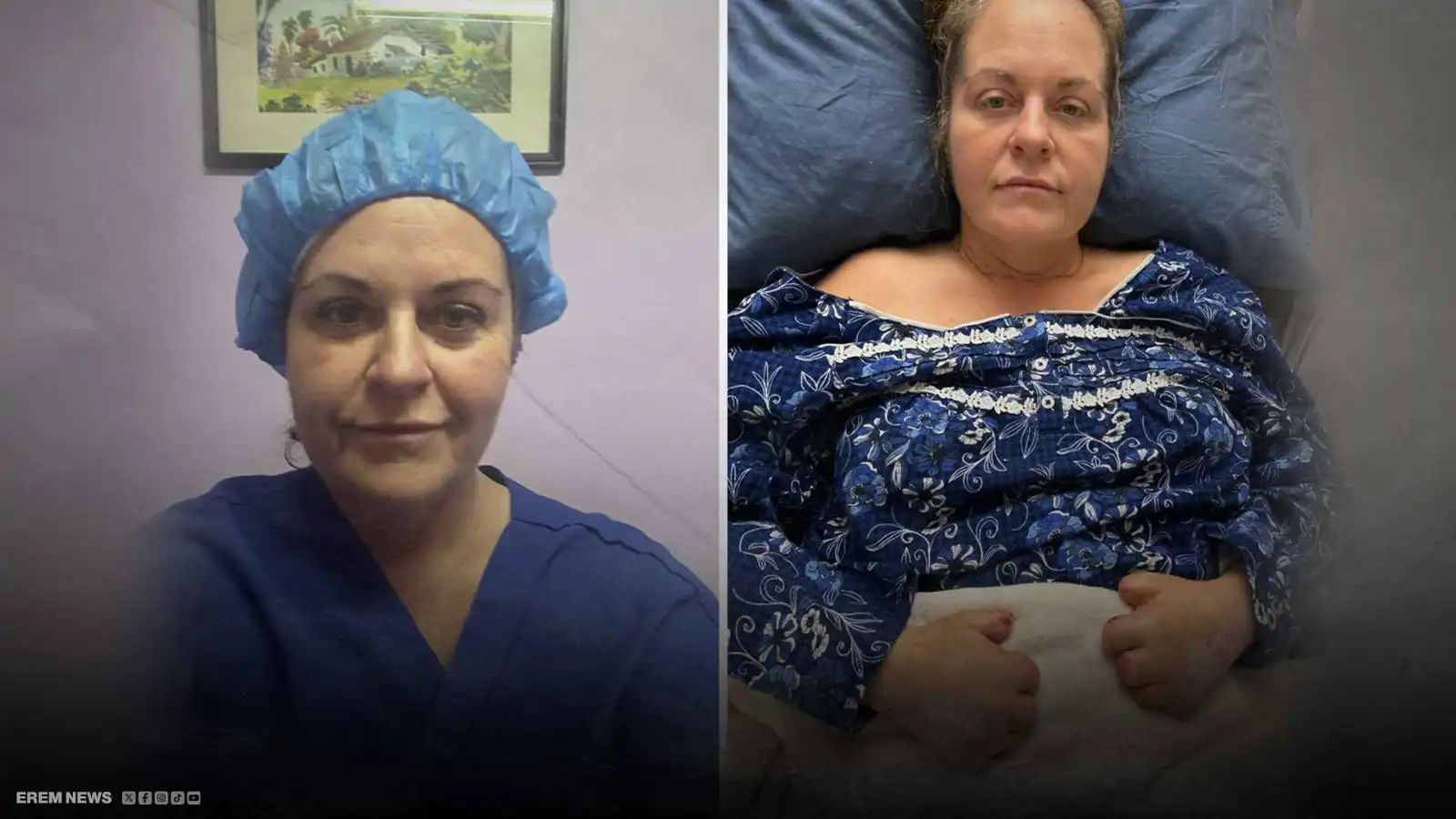 سافرت للتجميل فعادت بنصف أطرافها.. رحلة مأساوية لسيدة كندية (فيديو إرم)