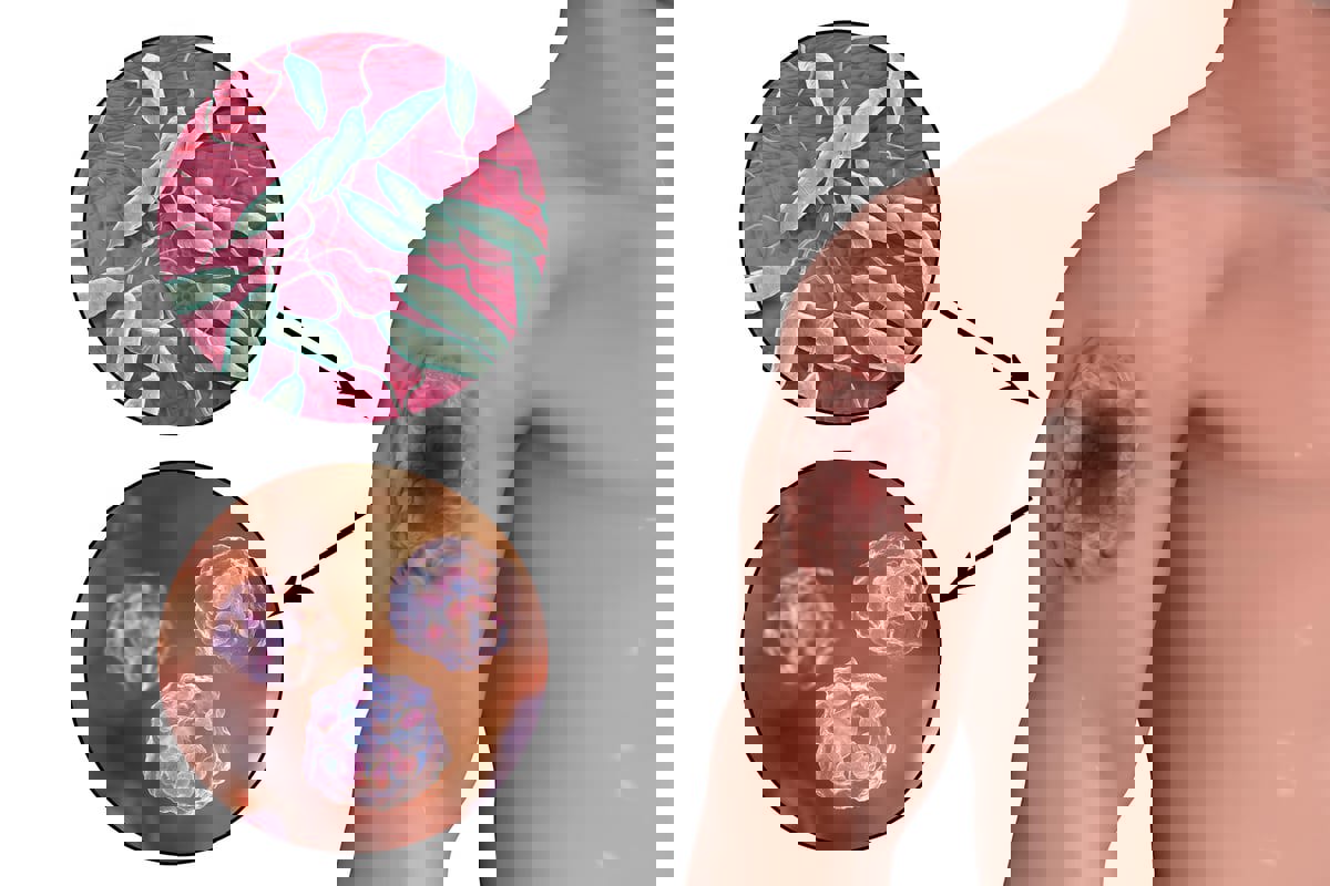 البكتيريا "آكلة اللحم" تنتشر بمعدل قياسي في اليابان