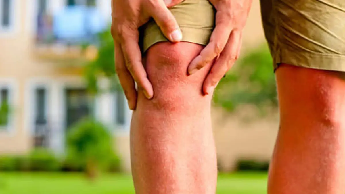 متى يصل العلماء إلى علاج شاف لمرض الروماتيزم؟