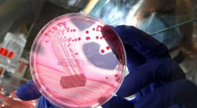 تقنية تكشف العدوى البكتيرية في الجسم خلال 30 دقيقة