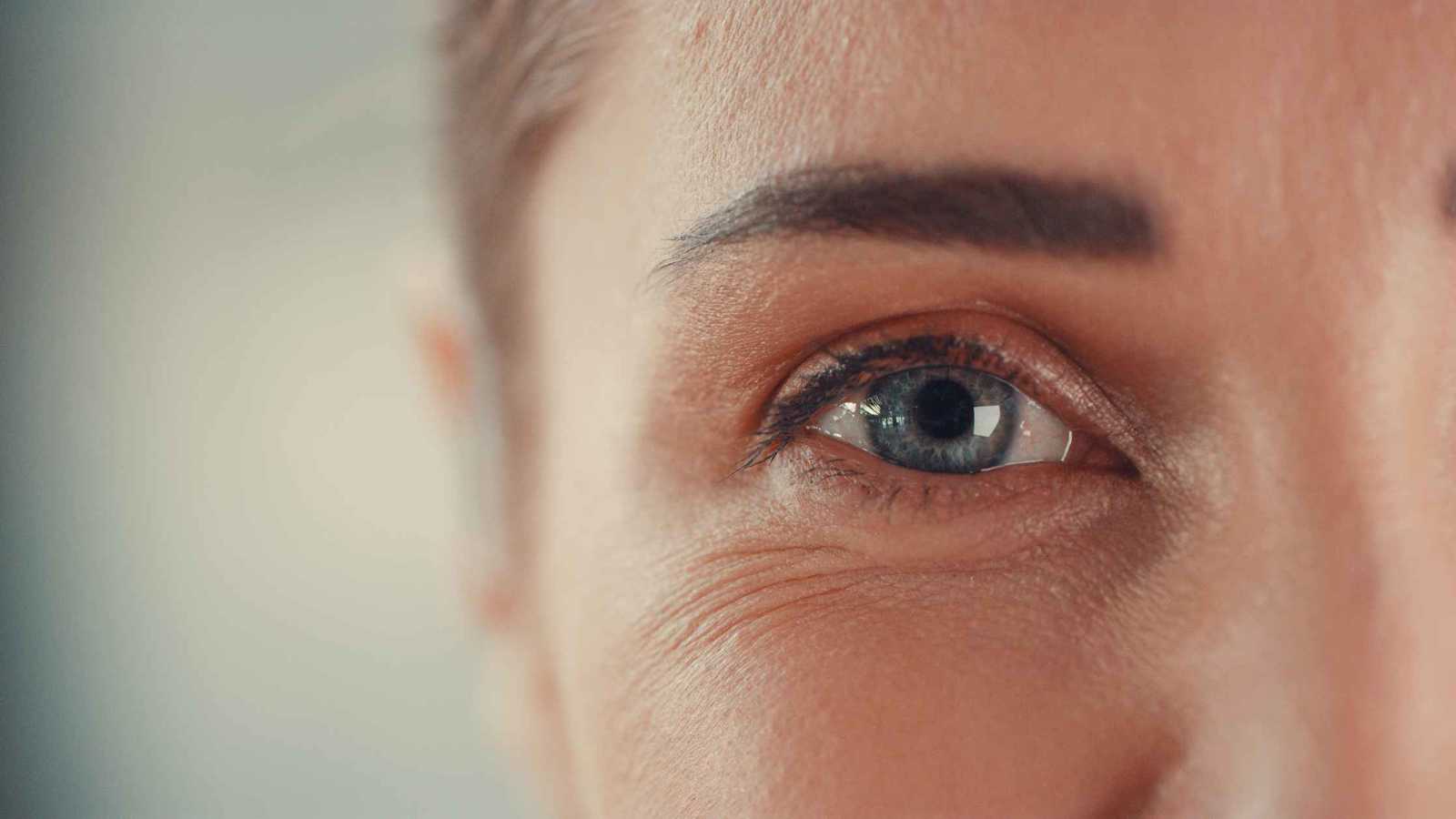 تجاعيد حول العينين.. دليل السعادة أم تقدم العمر؟