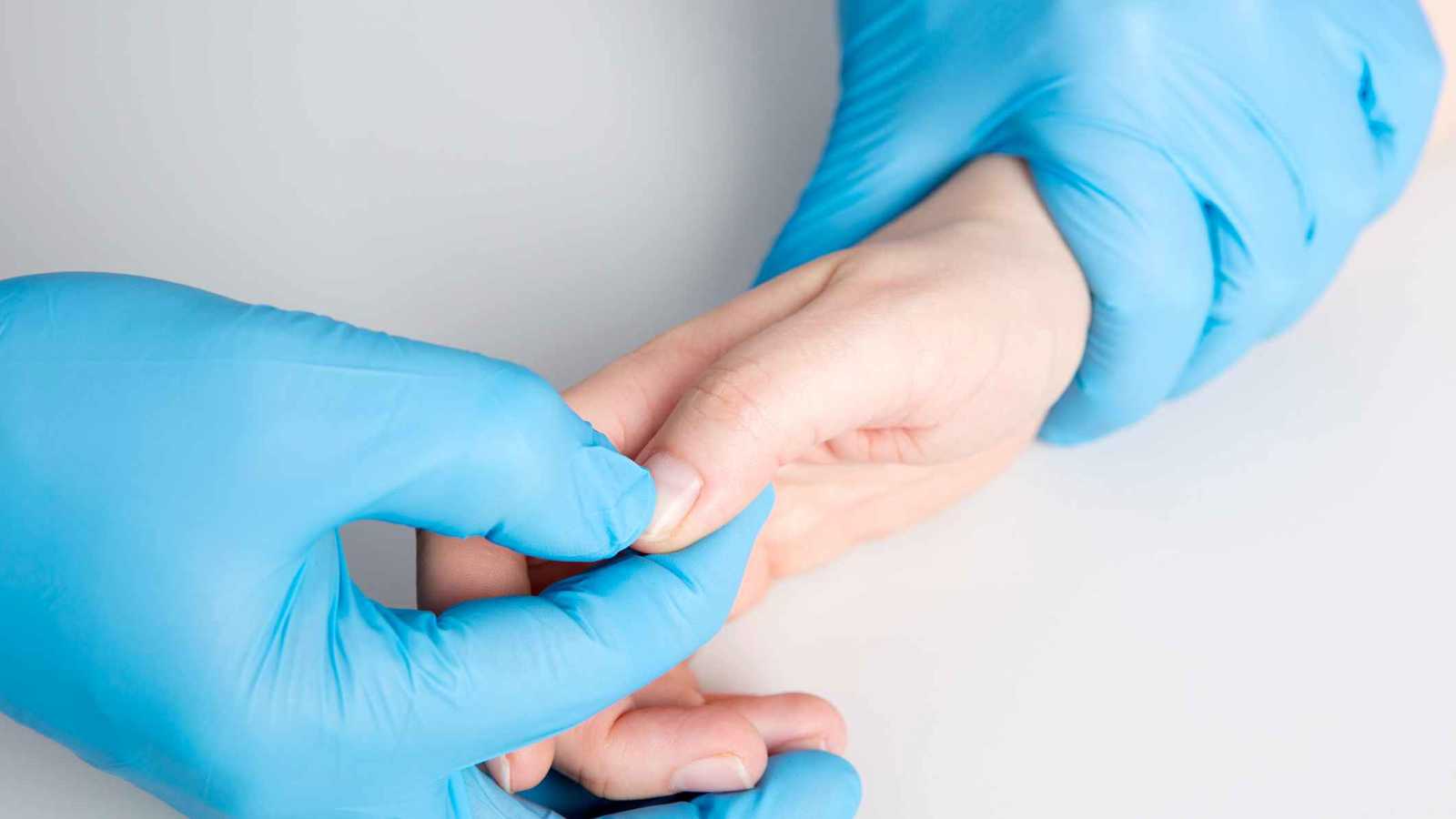 "اختبار الإبهام".. علامة بسيطة قد تكشف خطر تمدد الشريان الأورطي