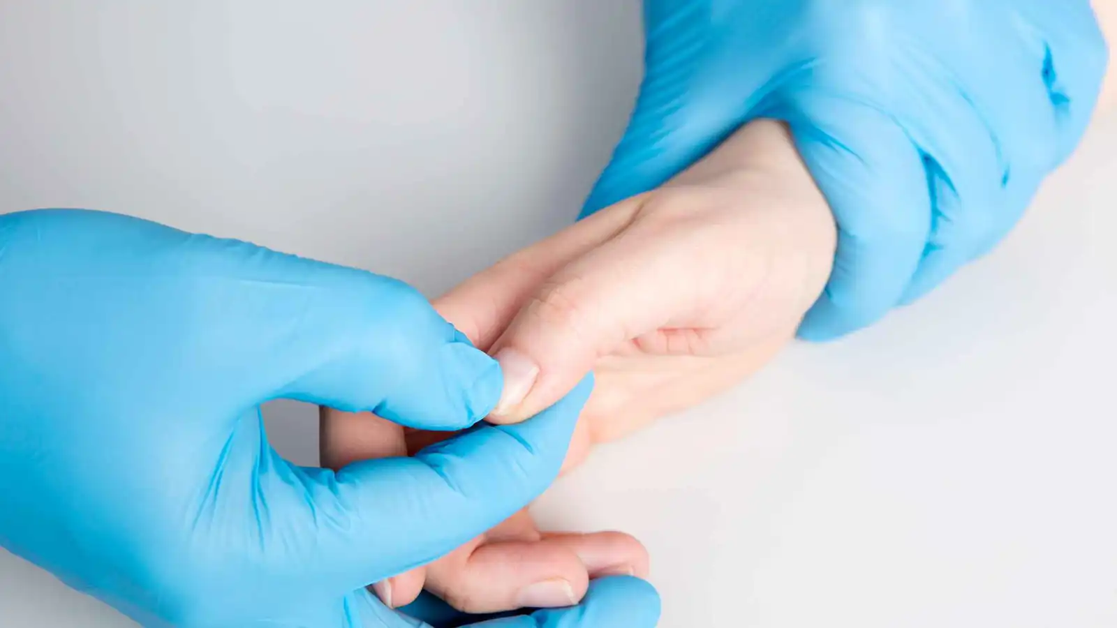 "اختبار الإبهام".. علامة بسيطة قد تكشف خطر تمدد الشريان الأورطي