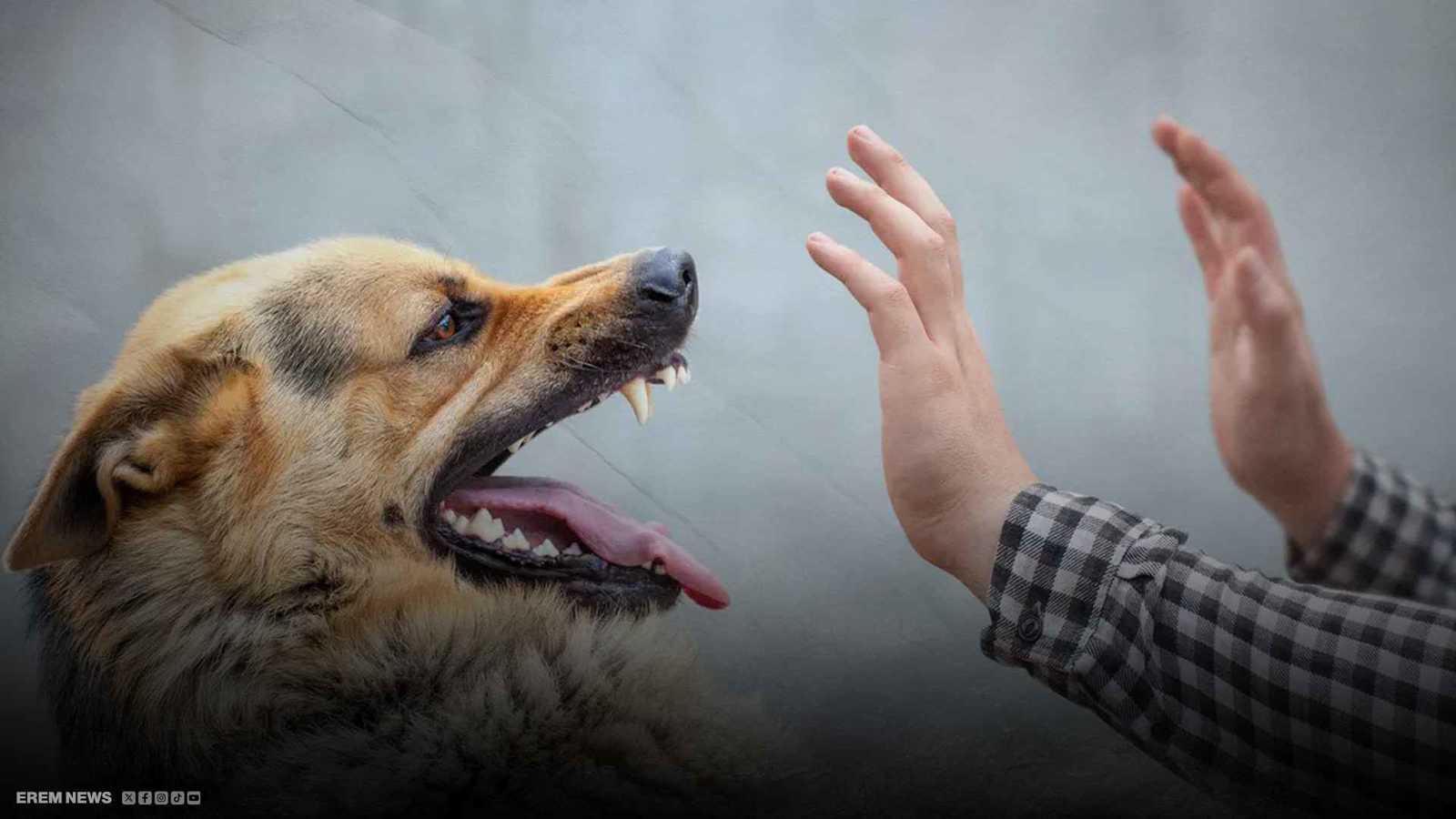 "عضة كلب".. وفاة عراقي بعد أعراض مميتة تثير الغضب