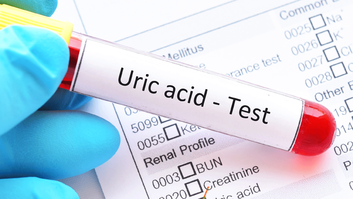 يسبب التهاب المفاصل.. 9 طرق لتقليل حمض اليوريك بشكل طبيعي في الجسم
