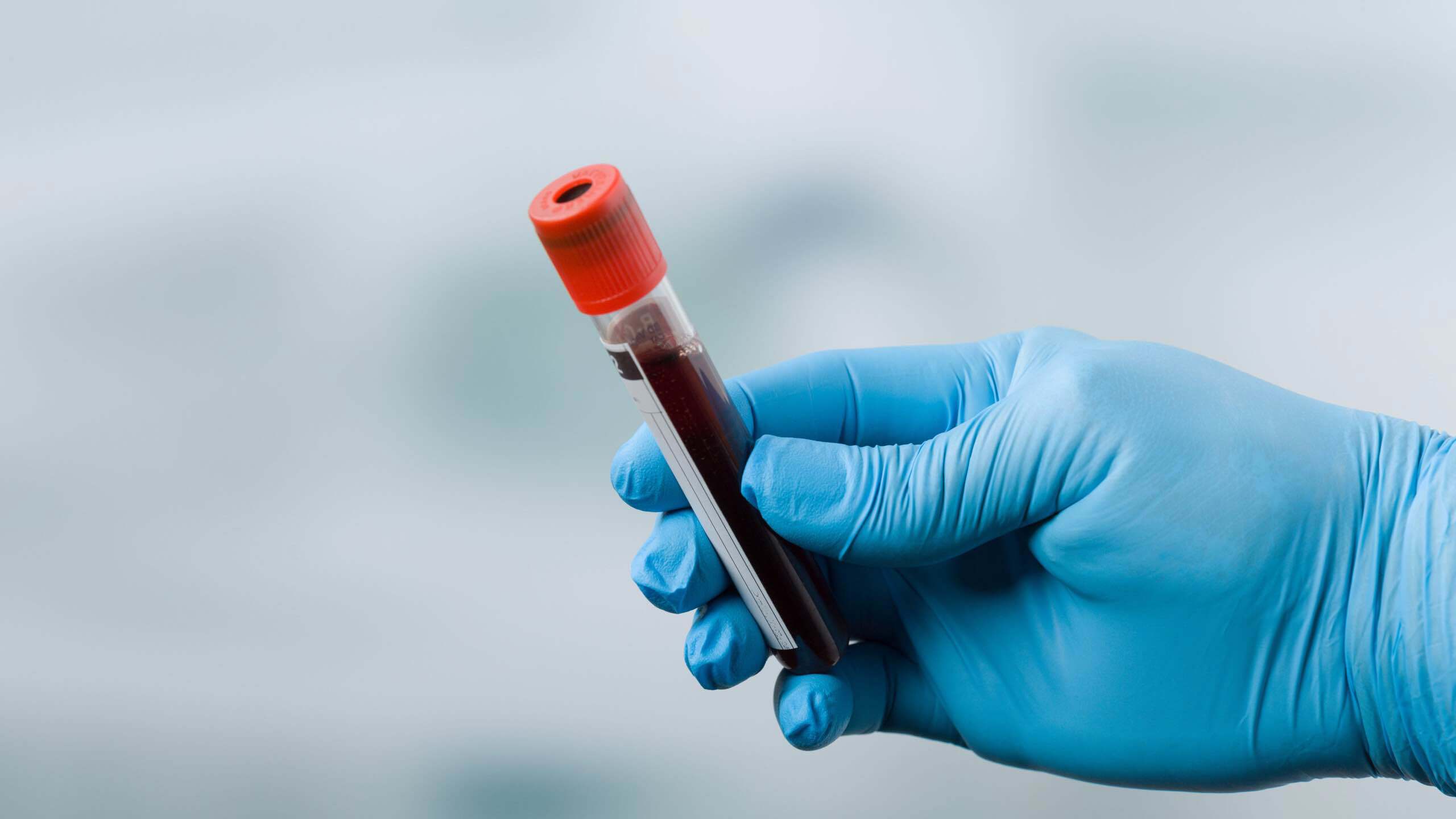 روسيا.. عقار جديد لعلاج سرطان البروستاتا