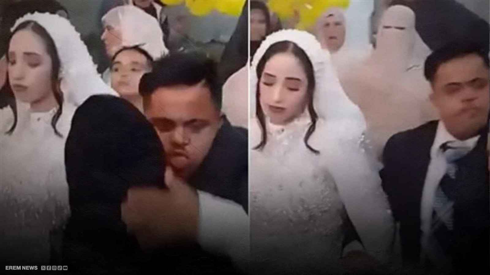 هل يجوز زواج شاب من متلازمة داون؟