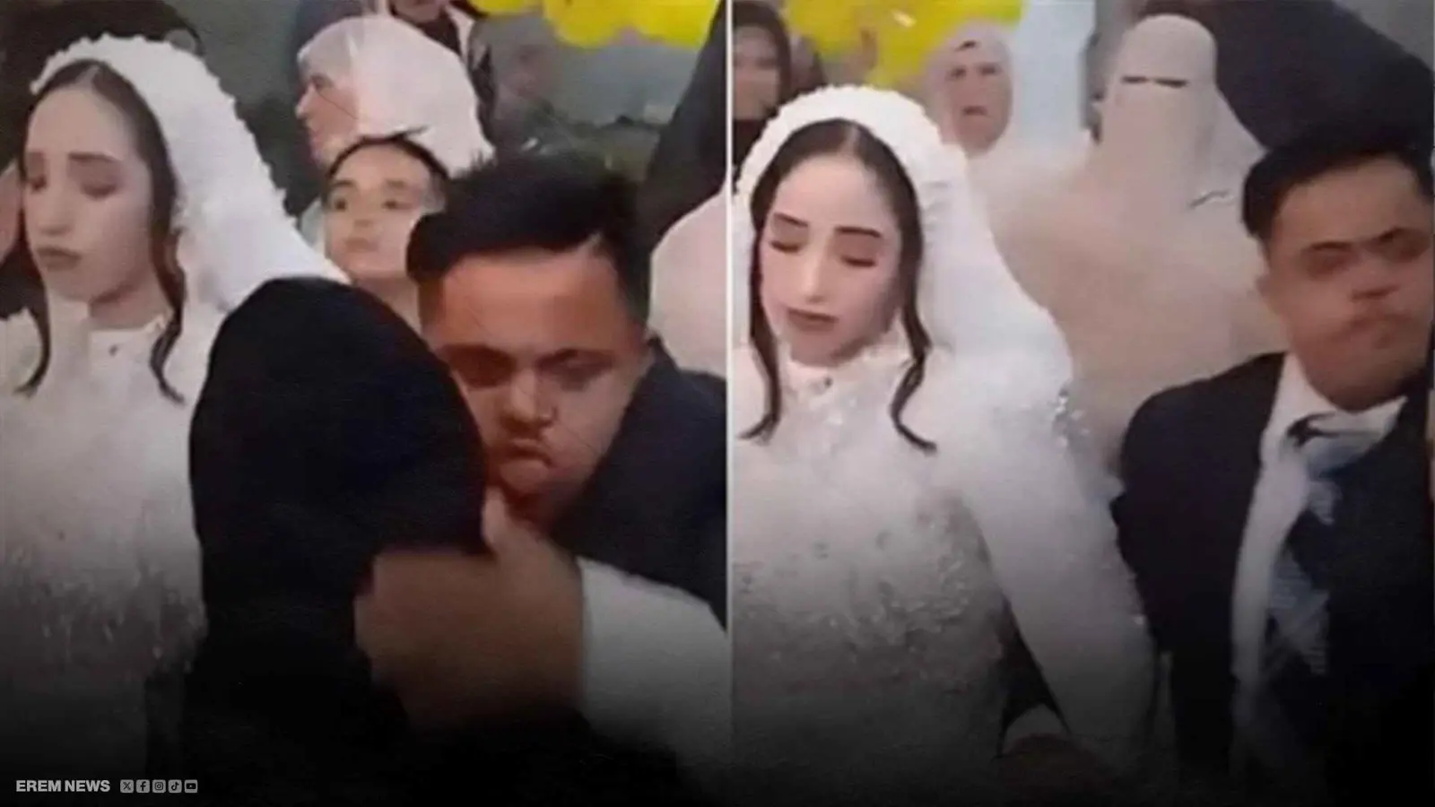 هل يجوز زواج شاب من متلازمة داون؟