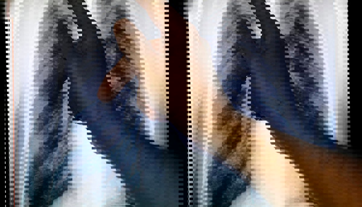 السُّلّ قتل الأشهرين