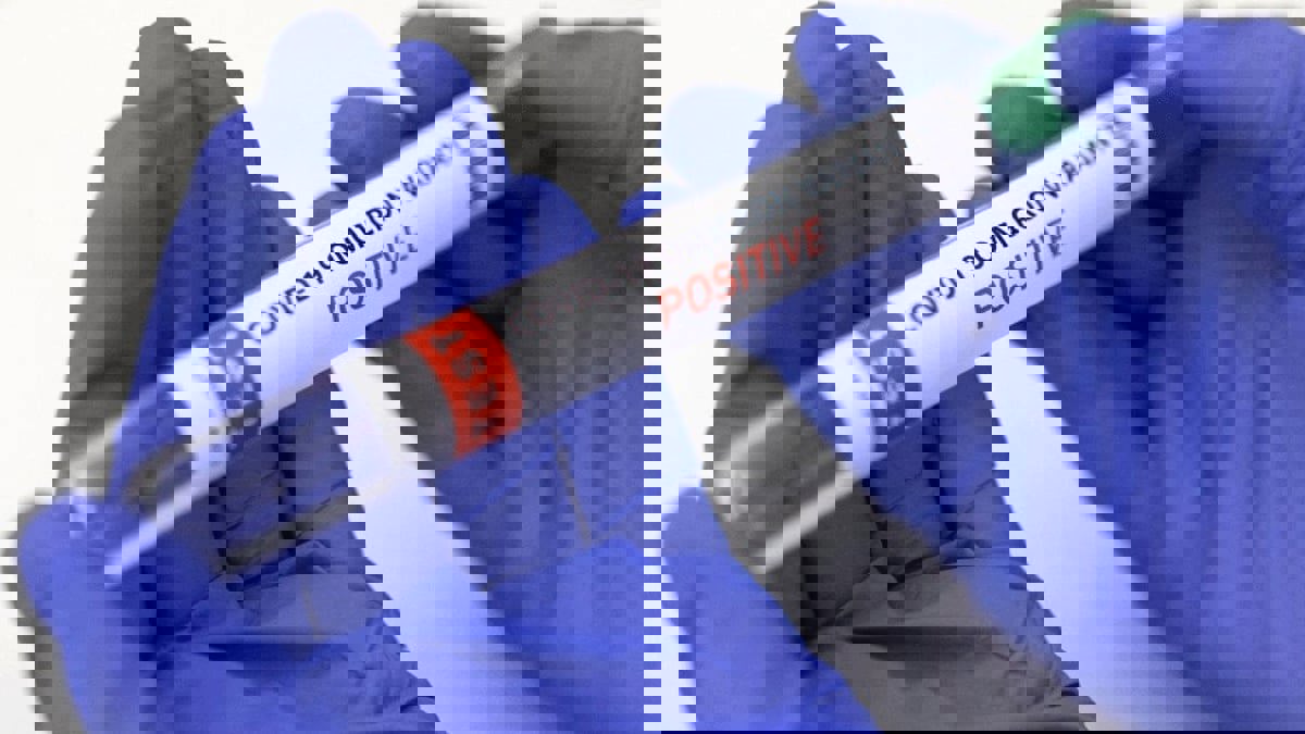 "سلالة جديدة متفجرة" قد تجدد وباء كورونا في بريطانيا