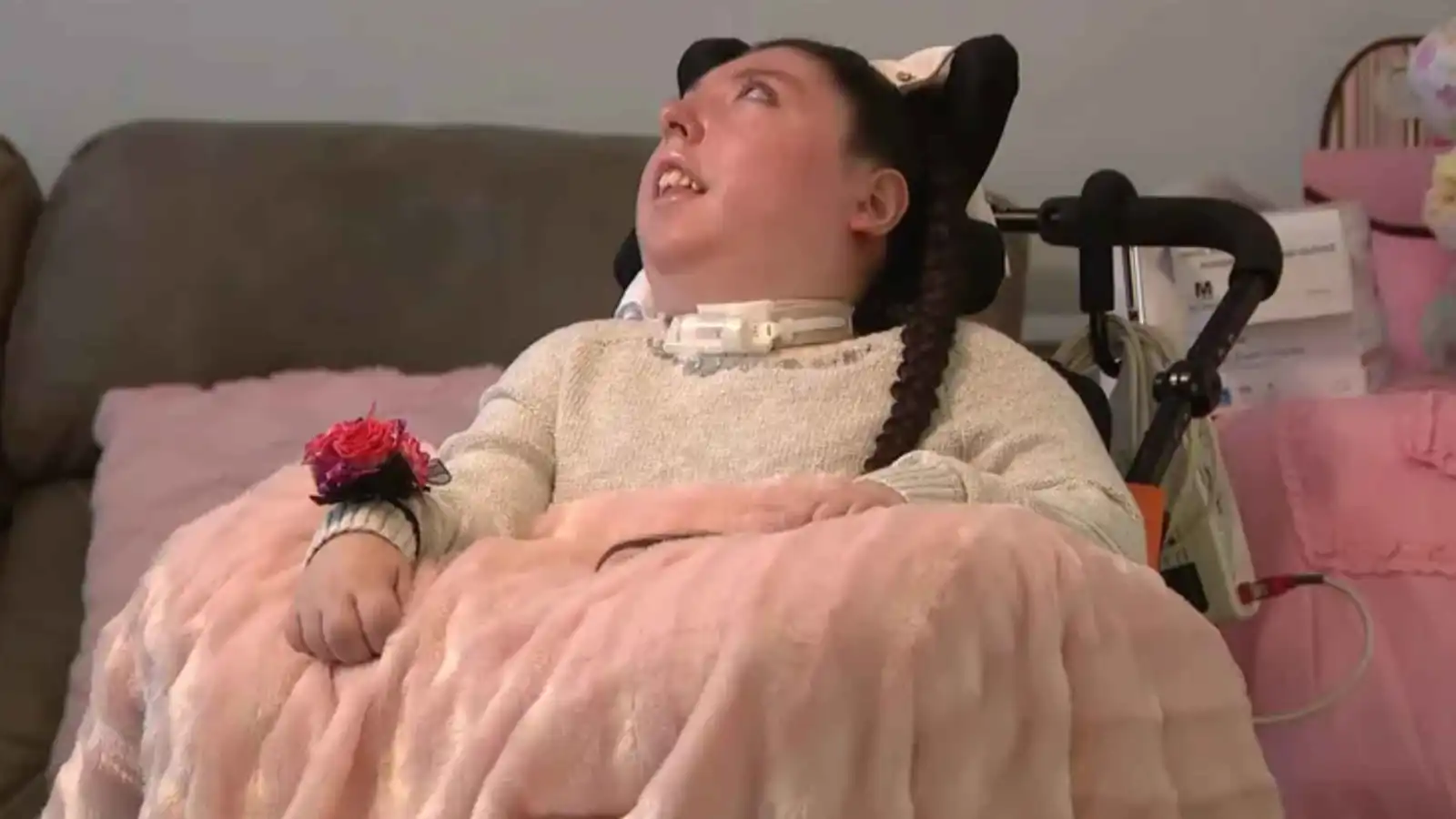 طفلة وُلدت بلا دماغ تحتفل بعيد ميلادها العشرين