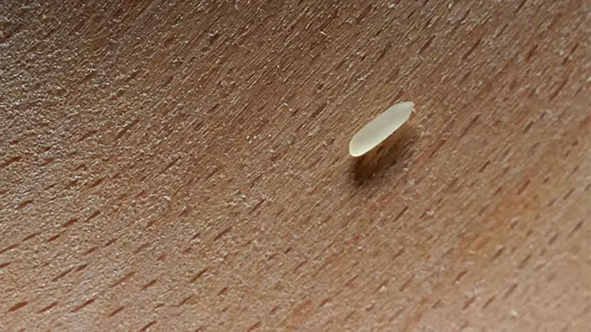 بحجم حبة أرز.. جهاز جديد لتنظيم ضربات القلب