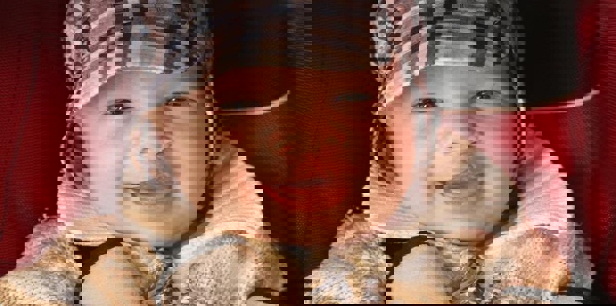 دراسة جديدة تكشف الآلية الوراثية المسببة لشق الشفاه