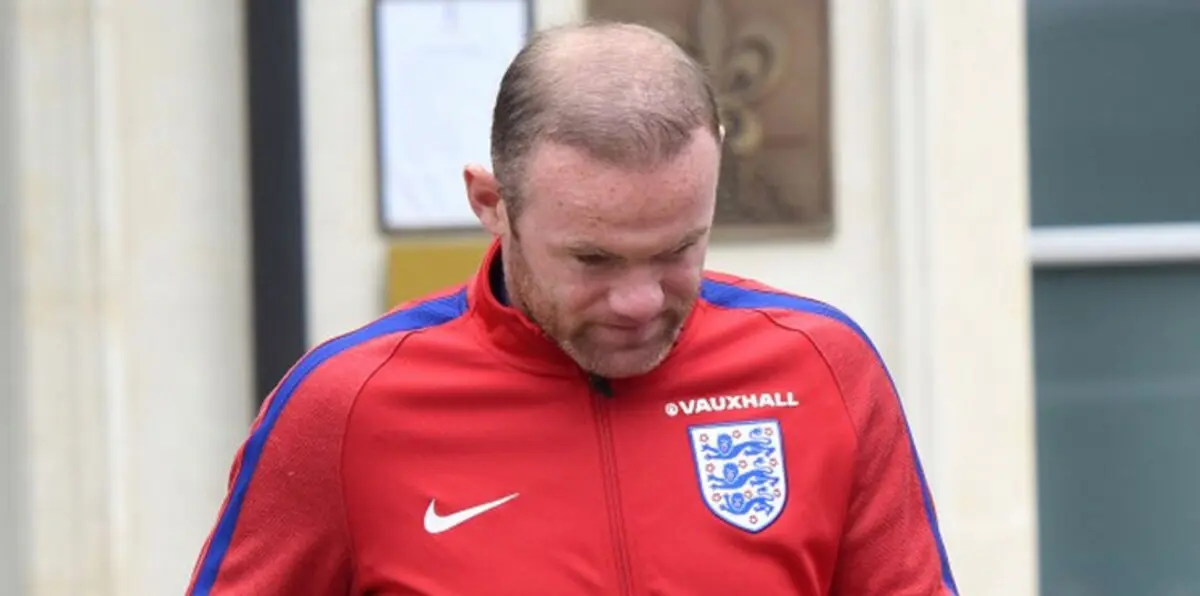 الصلع يغزو رأس روني مجددًا (صور)