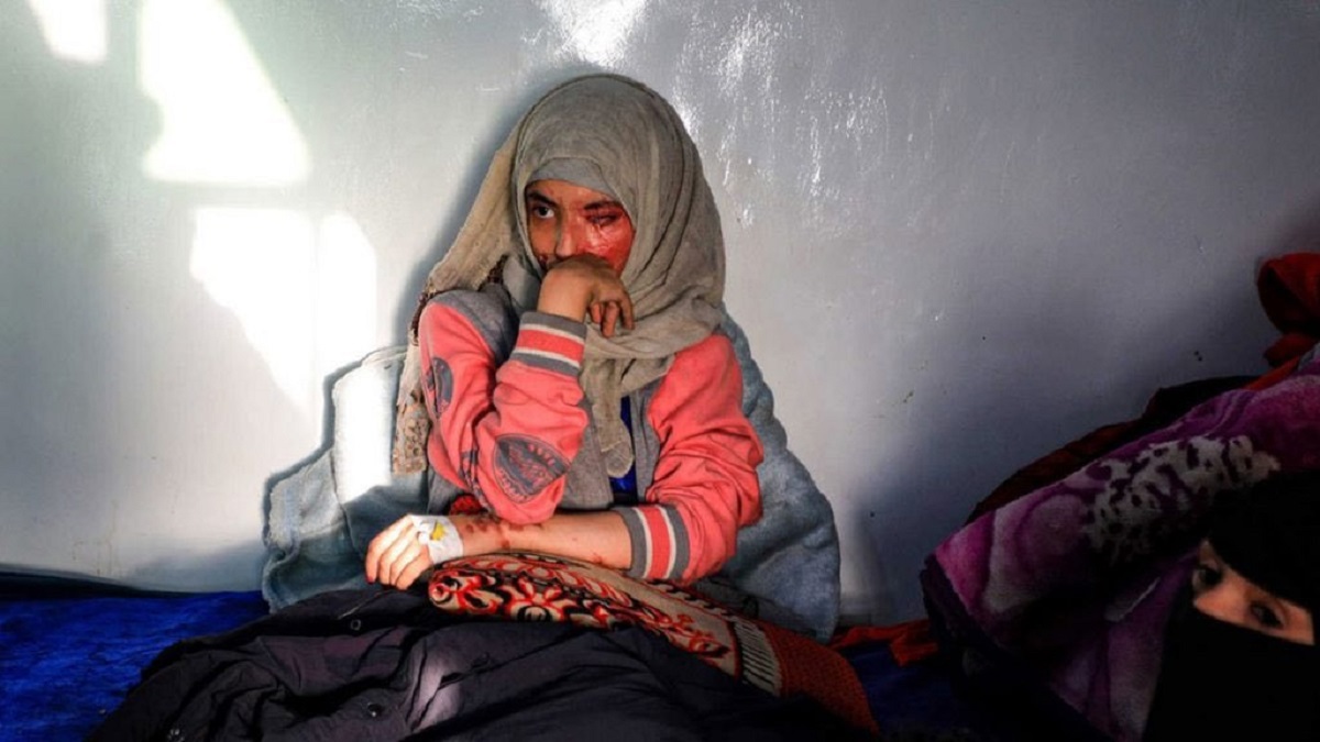 اليمن.. القبض على المتهم بحرق طليقته العنود حسين بمادة الأسيد‎‏