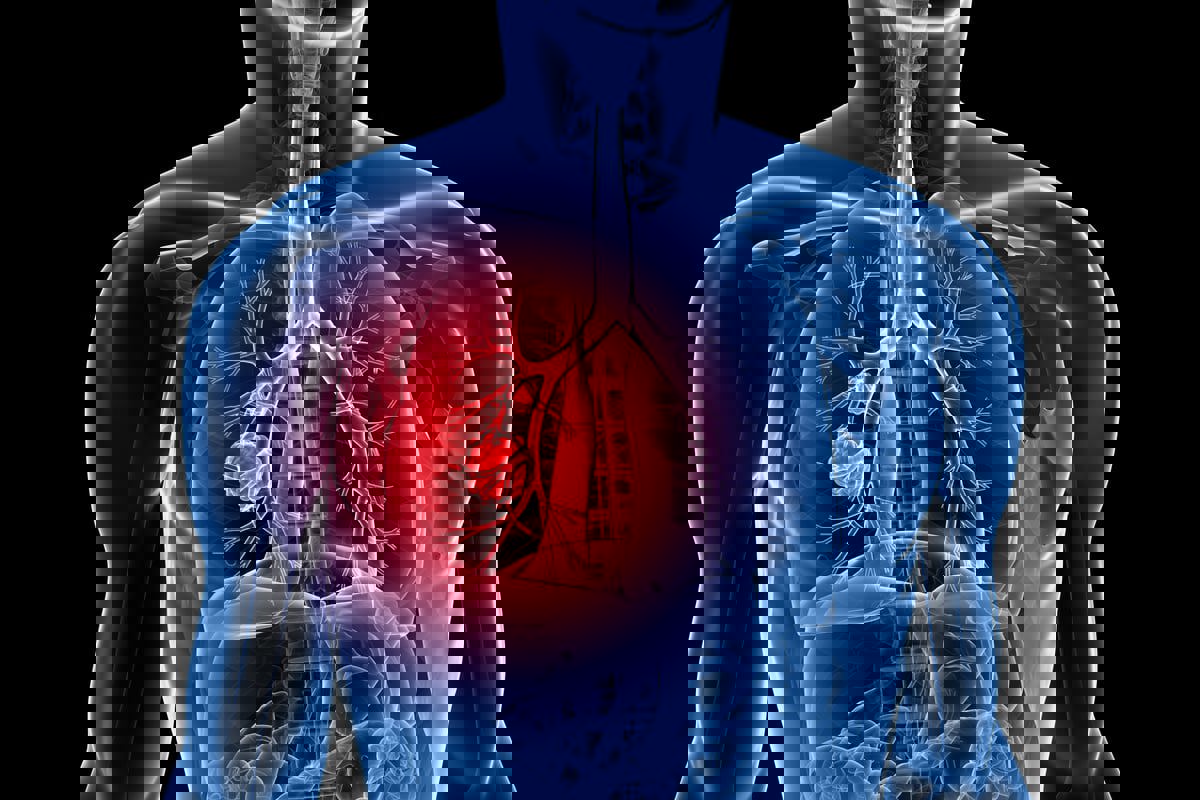 تطوير فحص دم يعزز دقة الكشف عن سرطان الرئة