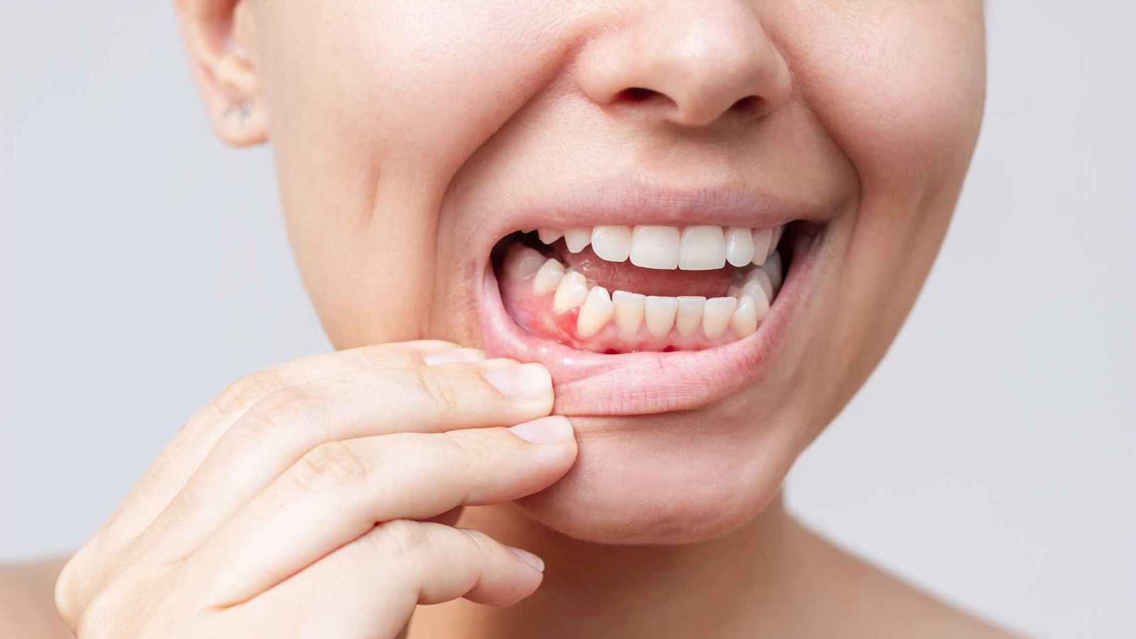 فوائد النظام المتوسطي تصل إلى صحة الفم واللثة