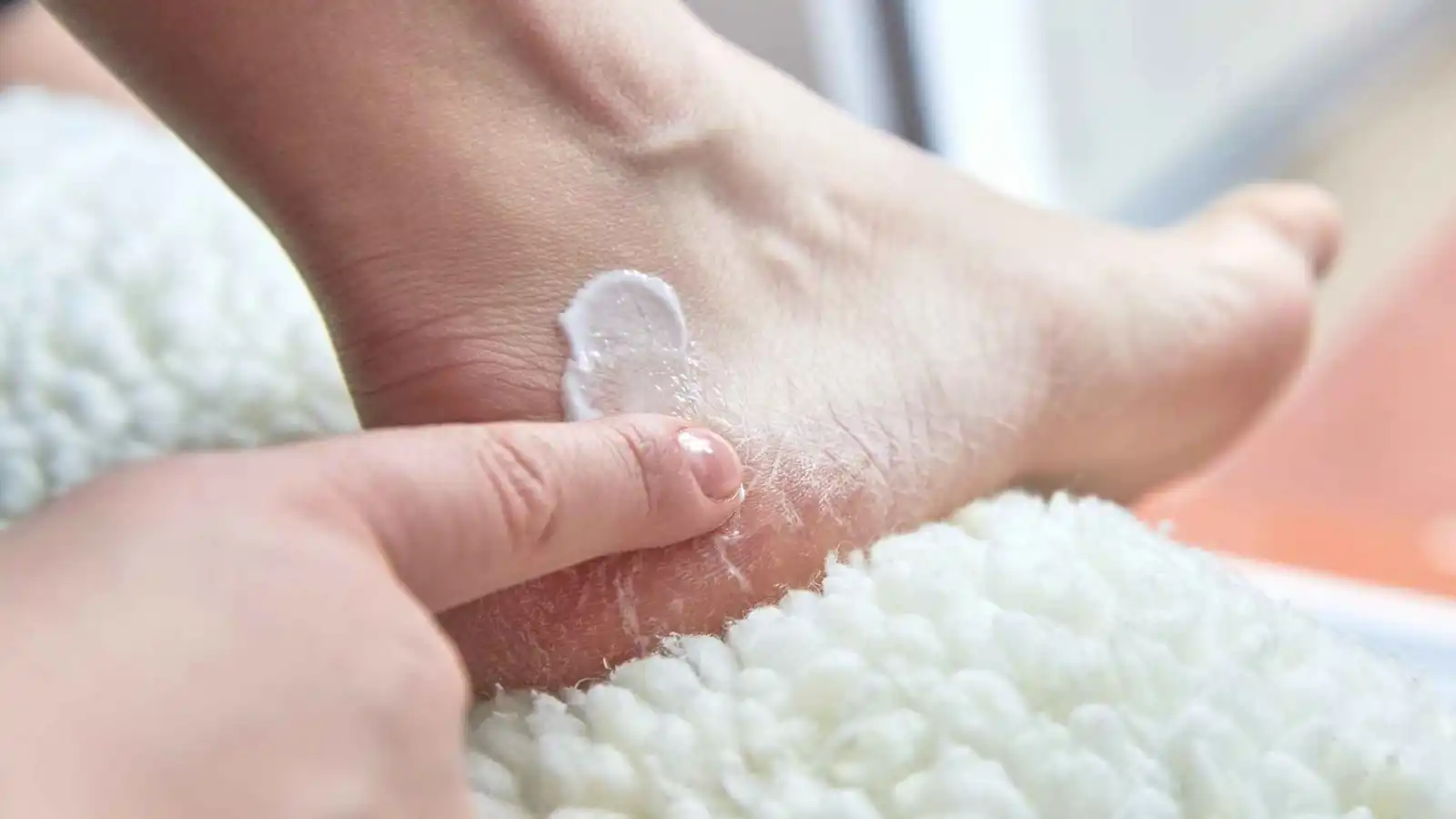 مع اقتراب الصيف.. كيف تتخلص من تقرحات القدم "الكالوس"؟