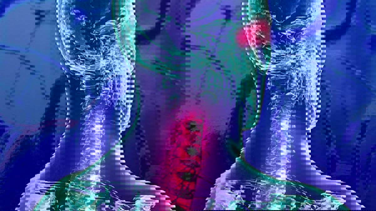 عناصر غذائية ضرورية لمرضى "التصلب المتعدد"