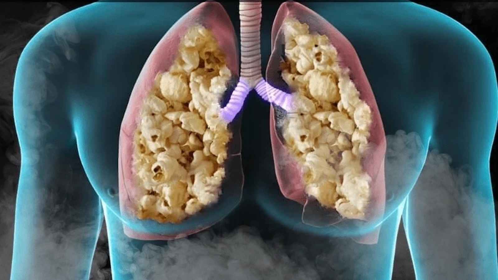 مرض "الفشار".. خطر يتربص برئتي مدخني السجائر الإلكترونية