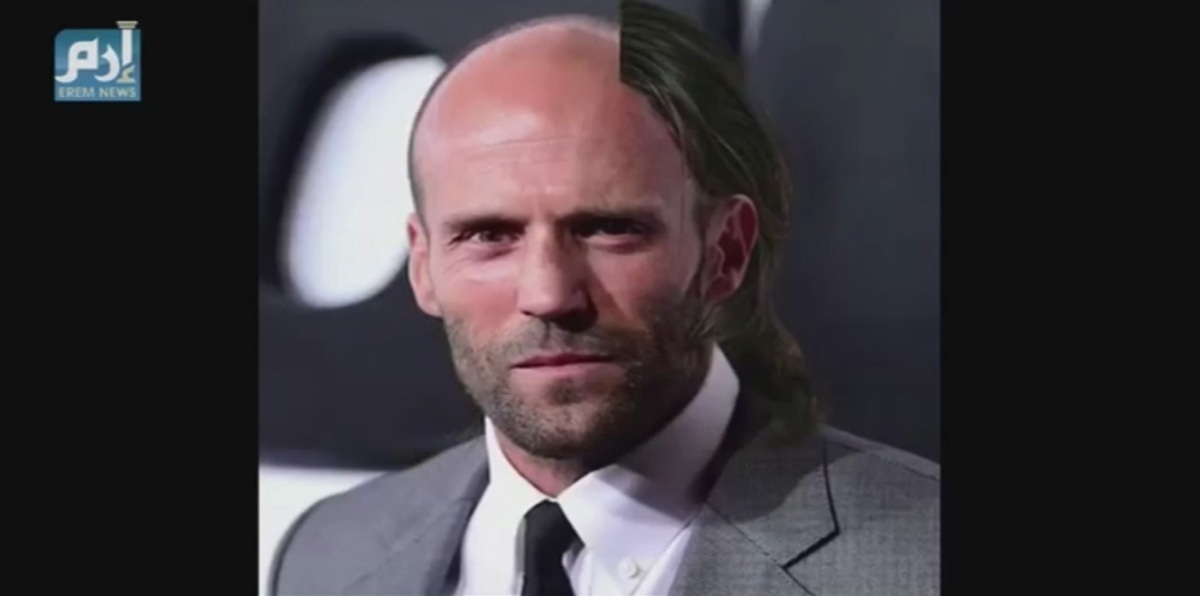 للصلعة جاذبية أيضاً (فيديو إرم)