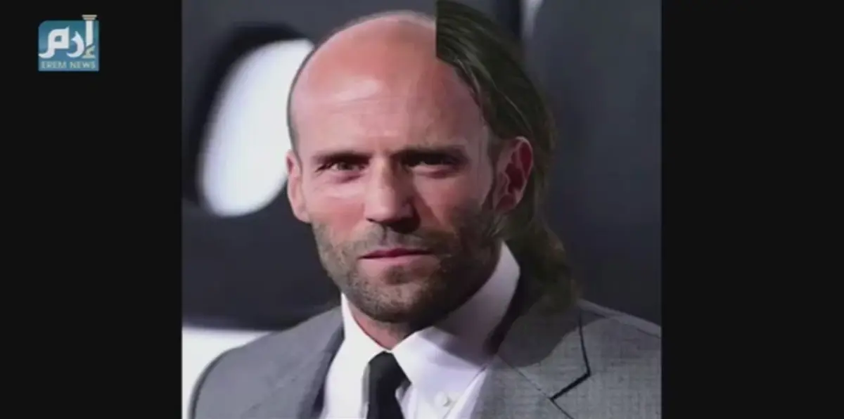 للصلعة جاذبية أيضاً (فيديو إرم)