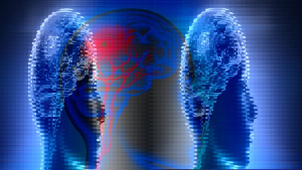 3 علاجات حديثة وواعدة لسرطان الدماغ