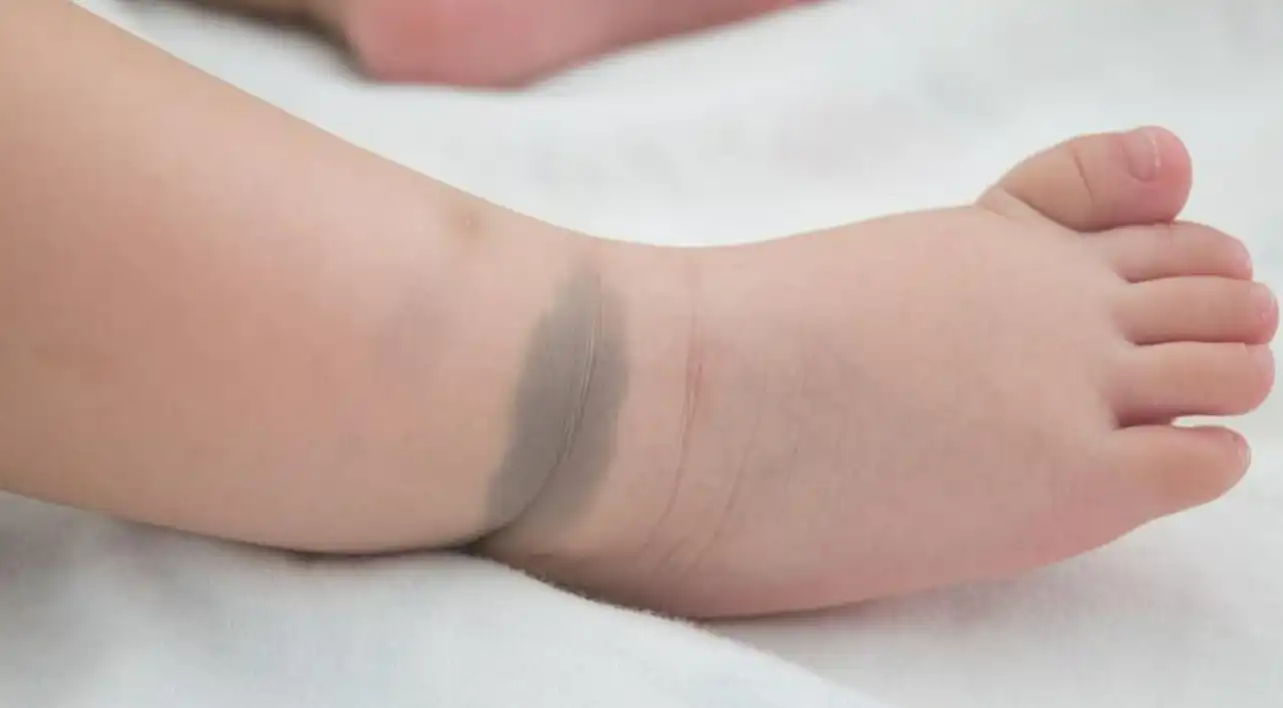 البقع المنغولية