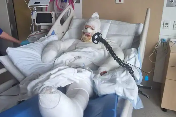 بينيلوب ترافرز