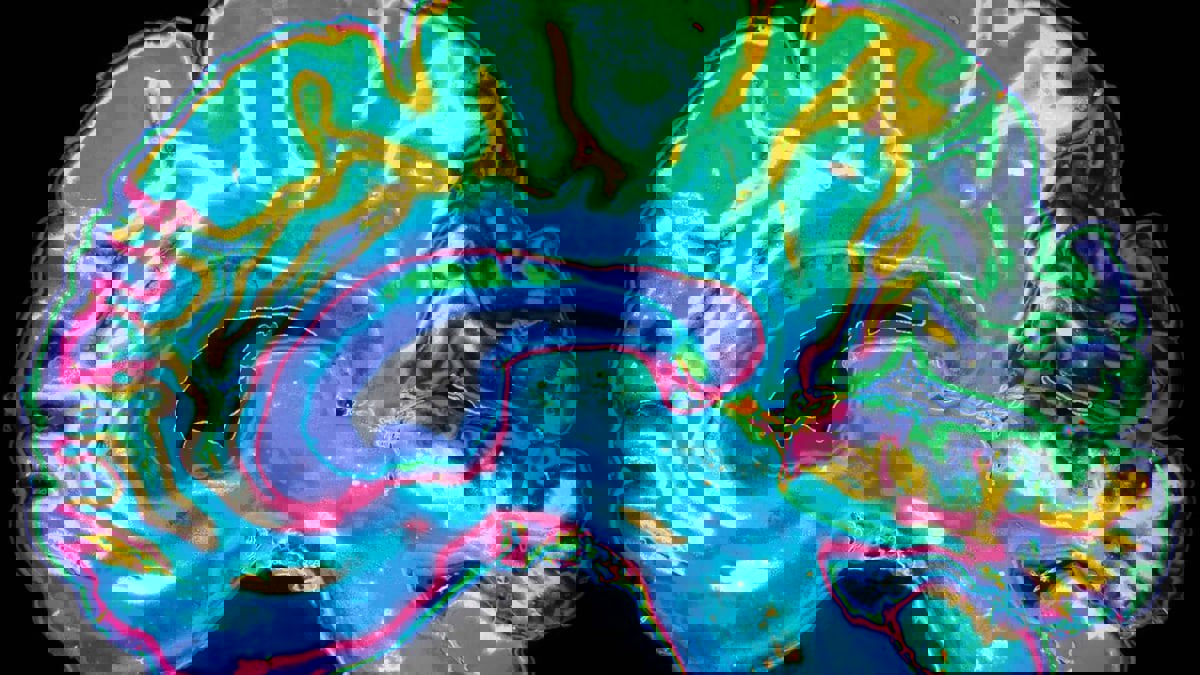 لأول مرة.. ابتكار قسطرة مستوحاة من أرجل الحشرات للتنقل في شرايين المخ