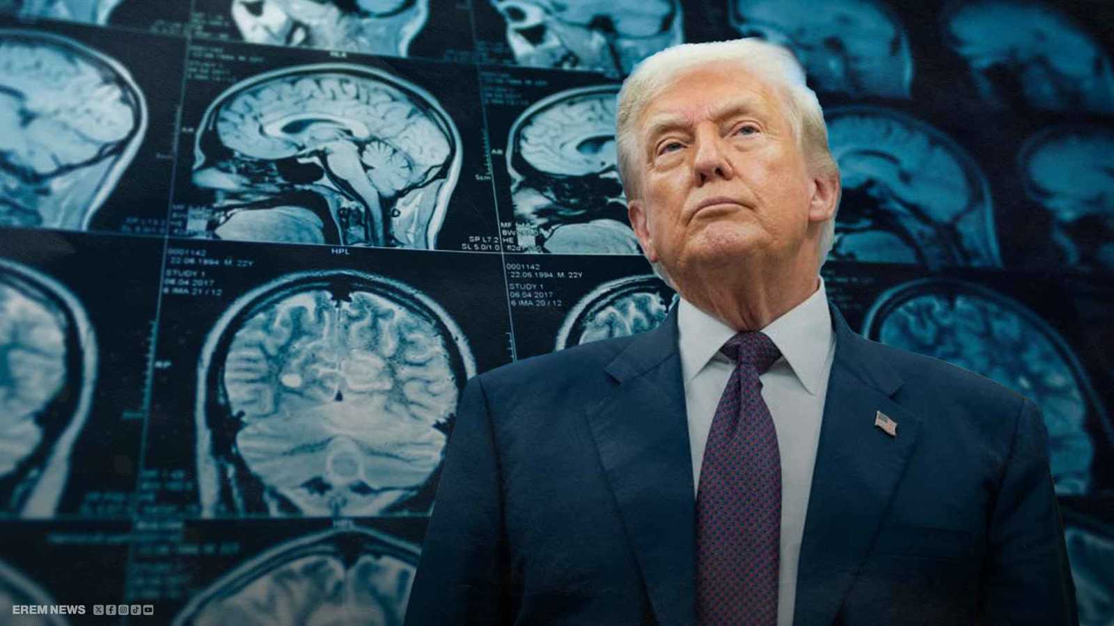 سؤال "الرنين المغناطيسي" يحاصره.. هل يعاني ترامب من مشاكل إدراكية؟ (فيديو إرم)