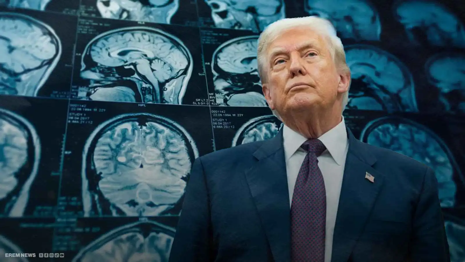 فحوص طبية تربك ترامب