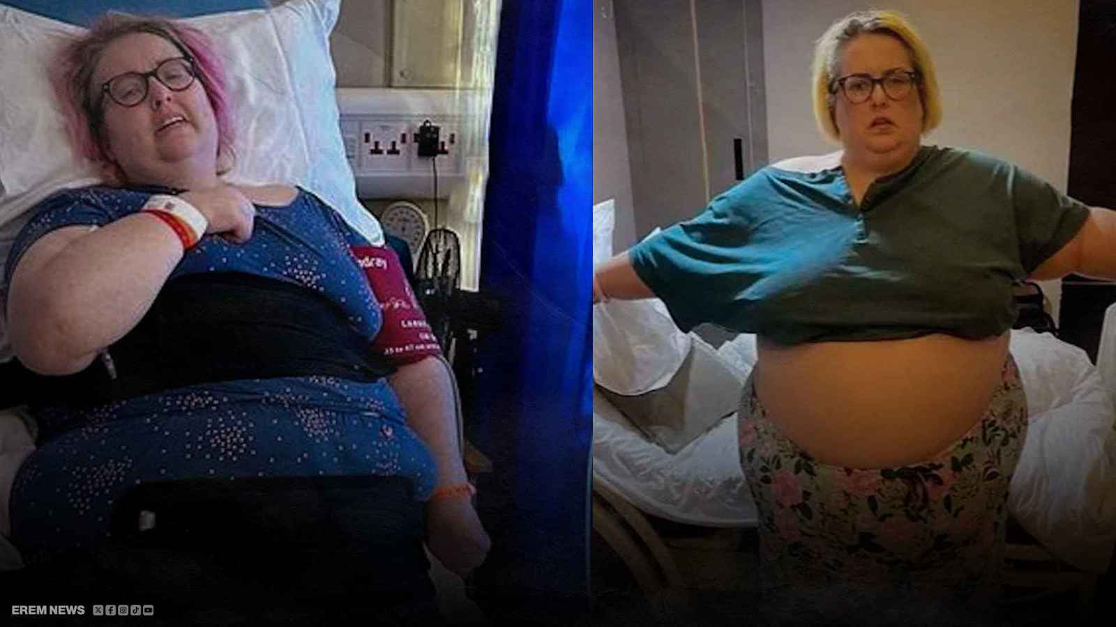 "ما وفرته من تكاليف خسرته صحةً".. كابوس لامرأة بريطانية أجرت عملية تنحيف "رخيصة"